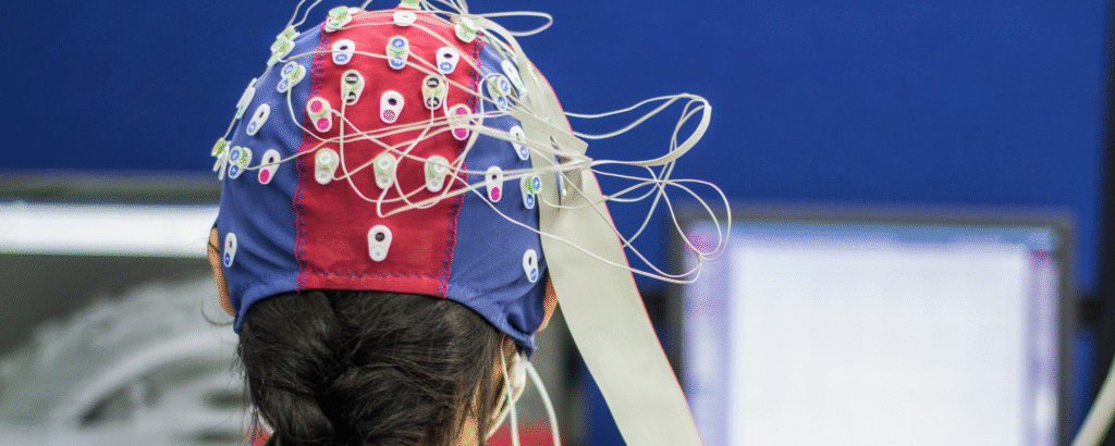 Estimulación Transcraneal por Corriente Directa (tDCS)