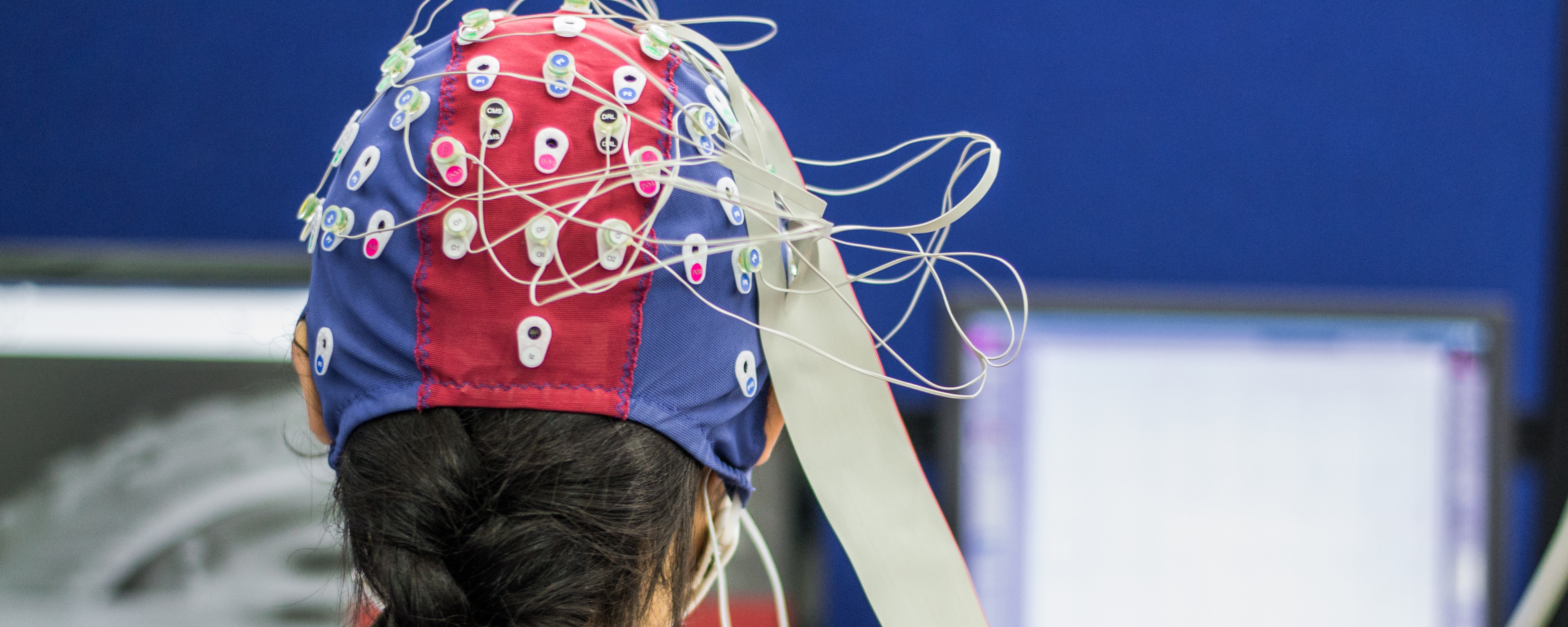 Técnicas y tratamientos 29 Estimulación Transcraneal por Corriente Directa (tDCS)